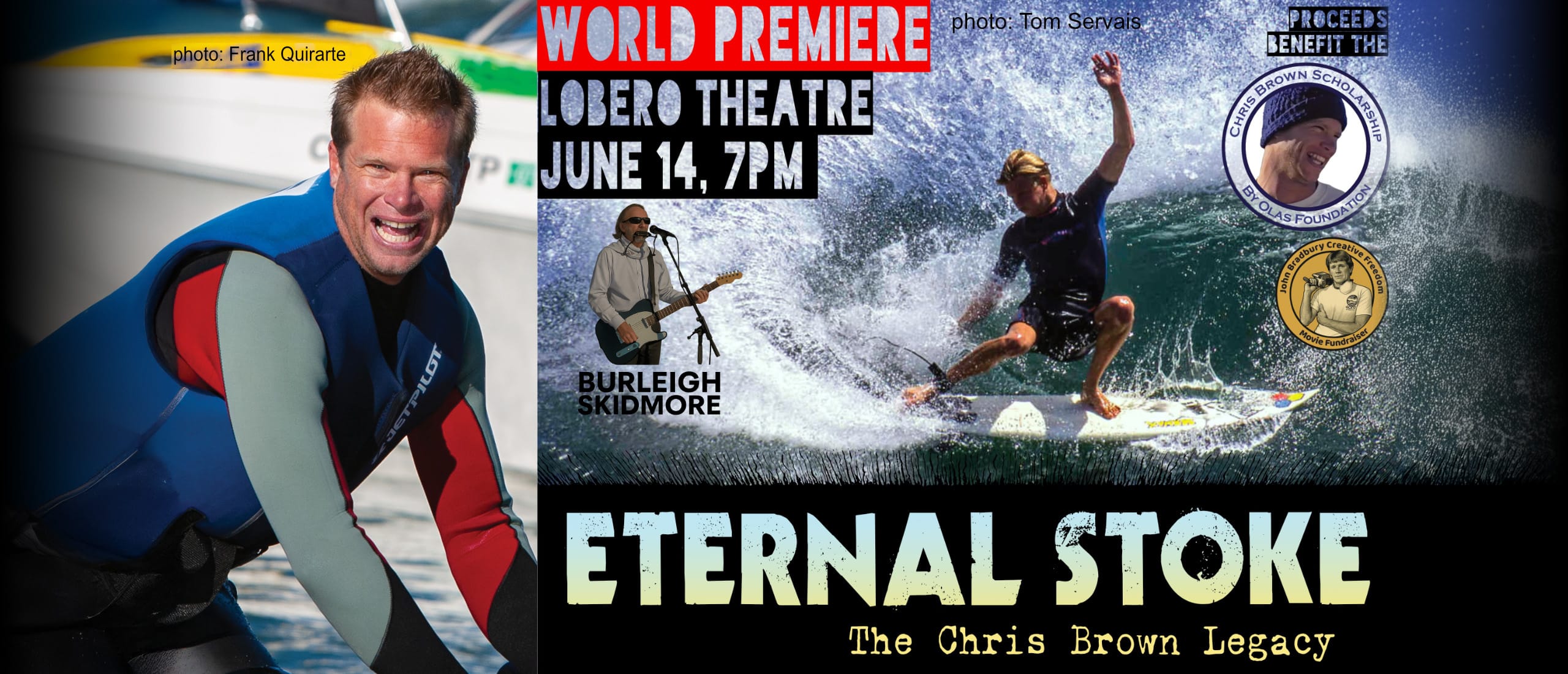 “Eternal Stoke”

